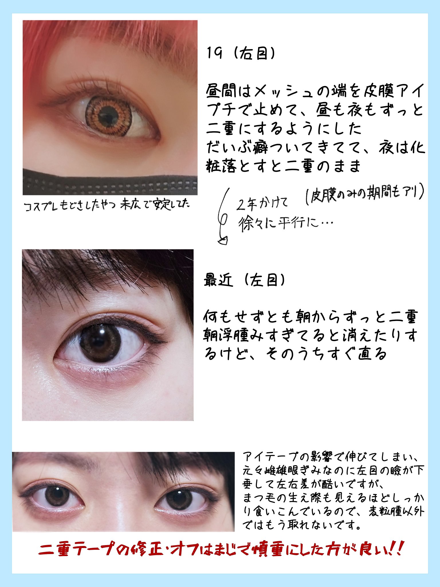 メッシュ アイテープ/shefun/二重まぶた用アイテムを使ったクチコミ（3枚目）