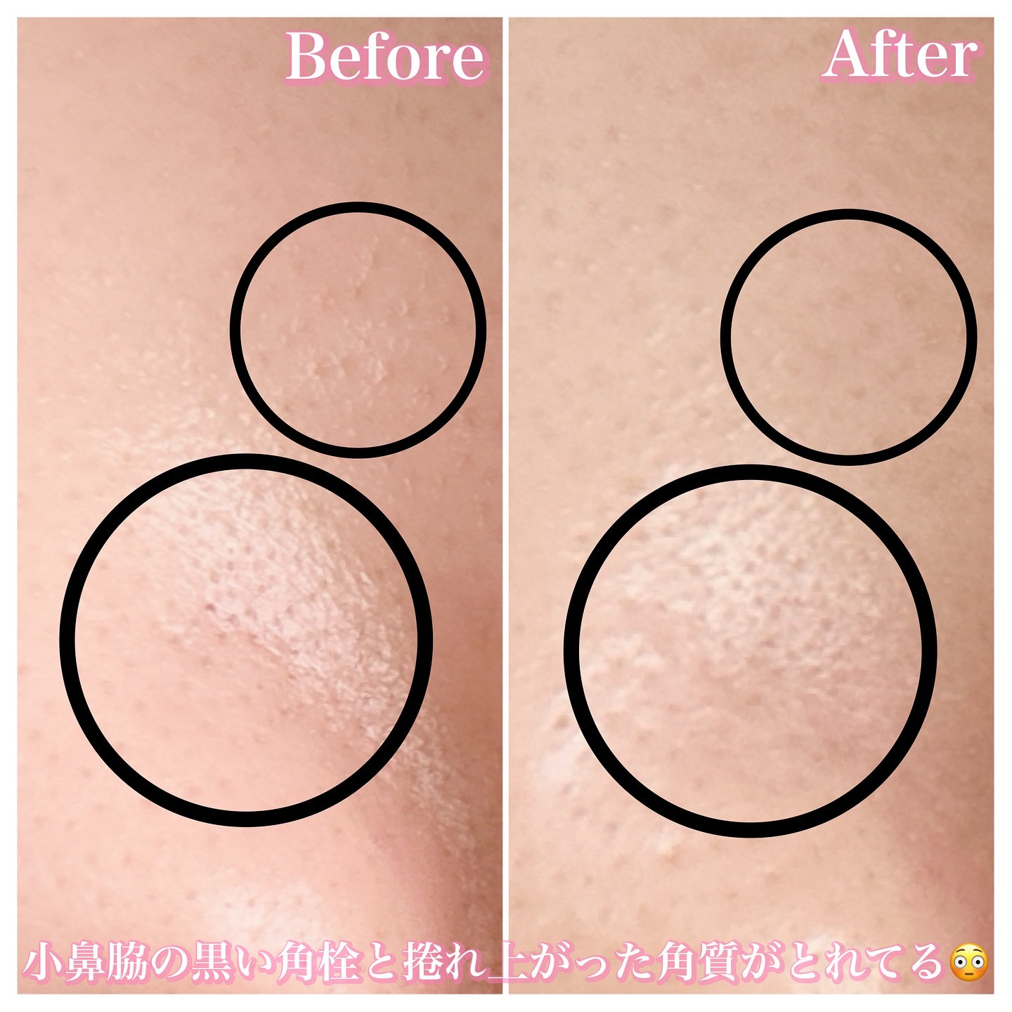 アレンシアフレッシュもちソープ「ロイヤルローズヒップ」/アレンシア/その他洗顔料を使ったクチコミ（3枚目）