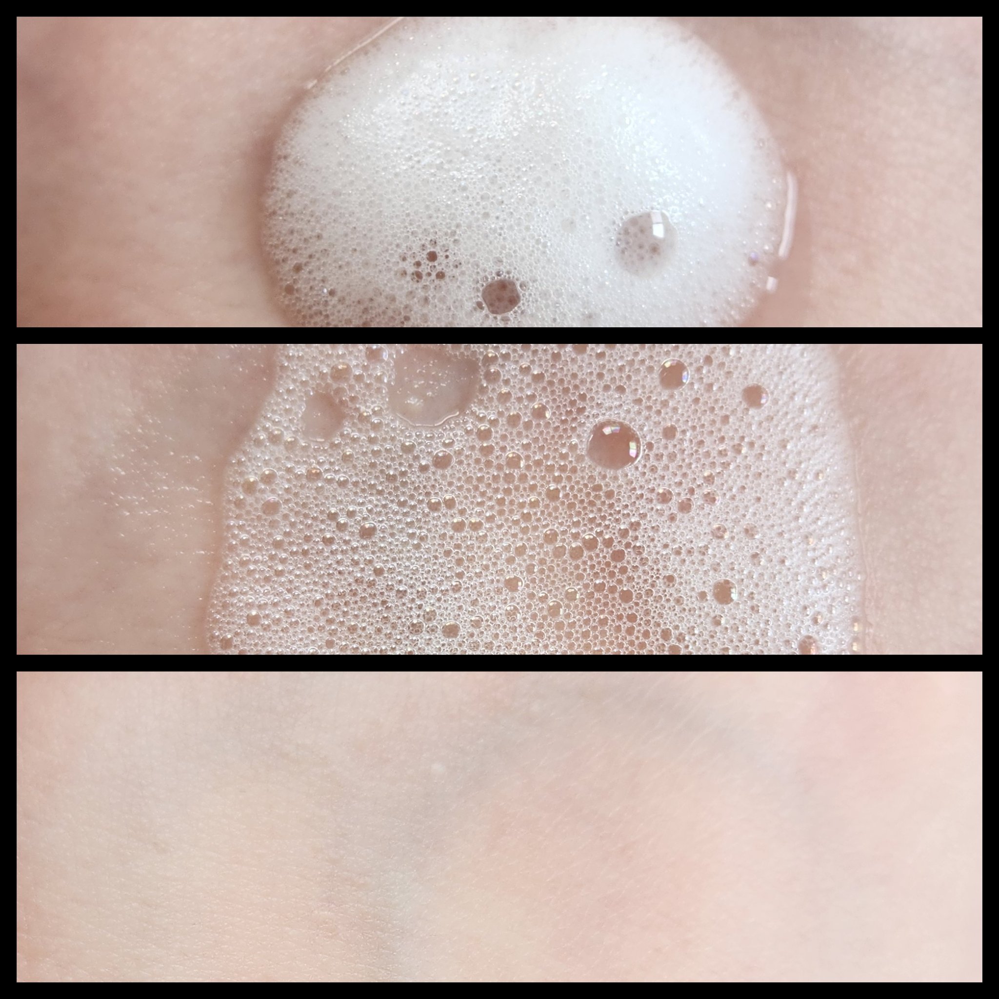 ブルービタミン バブルセラム エッセンス/SKIN SIGNAL/美容液を使ったクチコミ（3枚目）