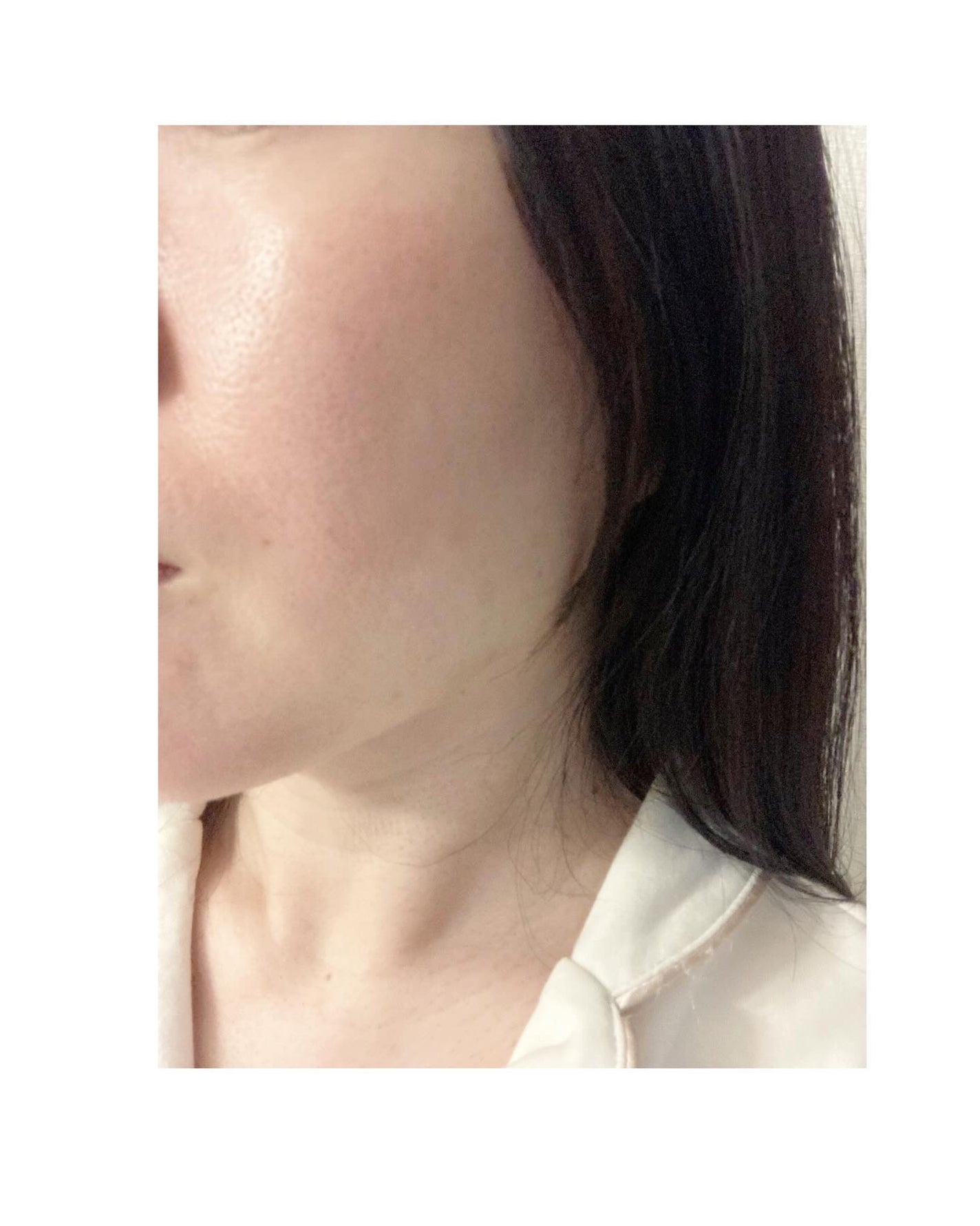 QuSomeホワイト2.0/b.glen/美容液を使ったクチコミ(4枚目)