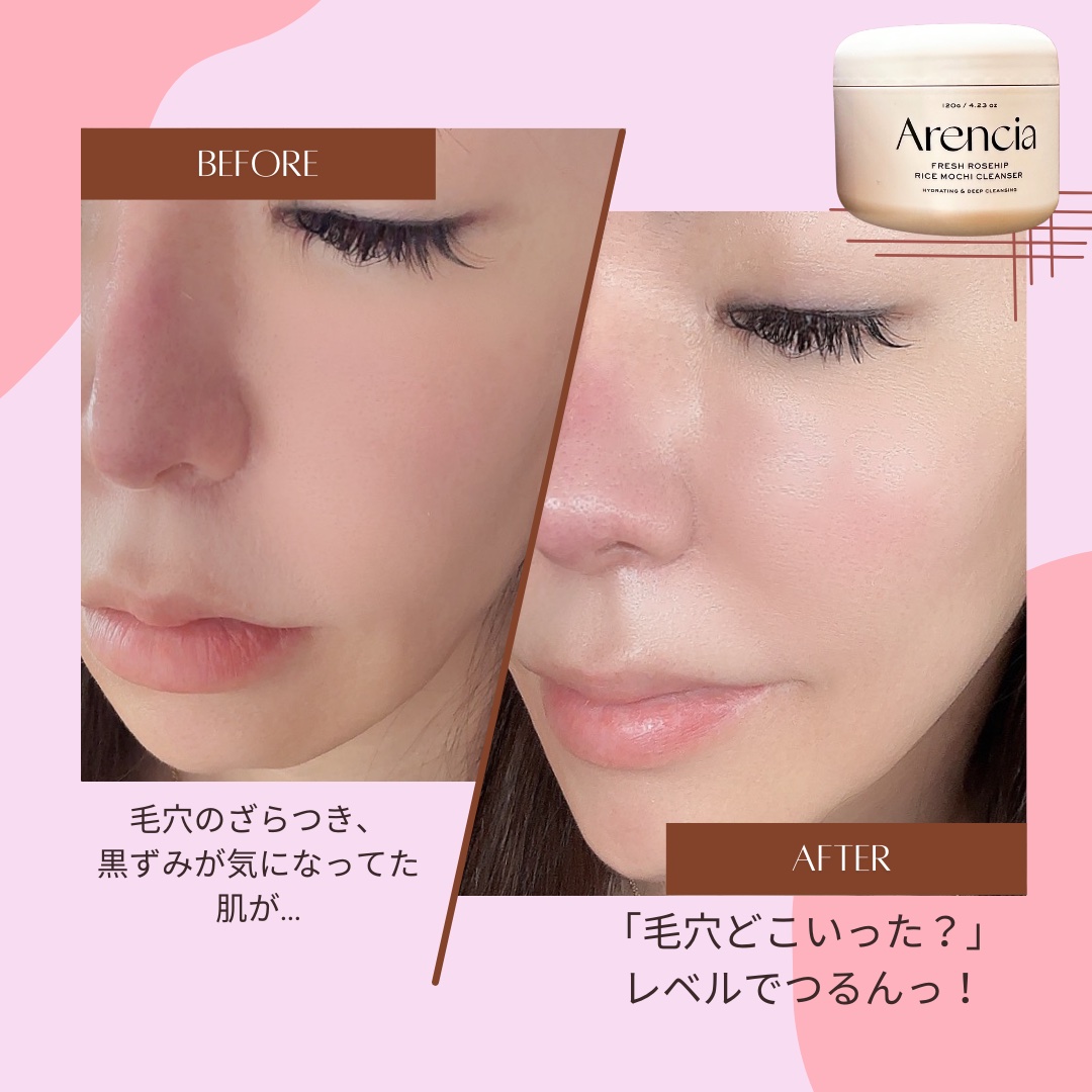 アレンシアフレッシュもちソープ「ロイヤルローズヒップ」/アレンシア/その他洗顔料を使ったクチコミ（2枚目）