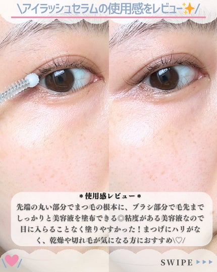 アーニストアイラッシュセラム/BENTON/まつげ美容液を使ったクチコミ(8枚目)
