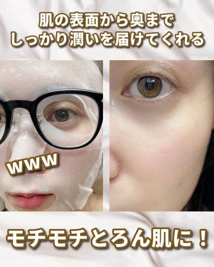 桃70%ナイアシンシートマスク/Anua/シートマスク・パックを使ったクチコミ(4枚目)