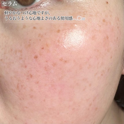 ビタ 5X PDRNセラム/D'amu/美容液を使ったクチコミ(5枚目)