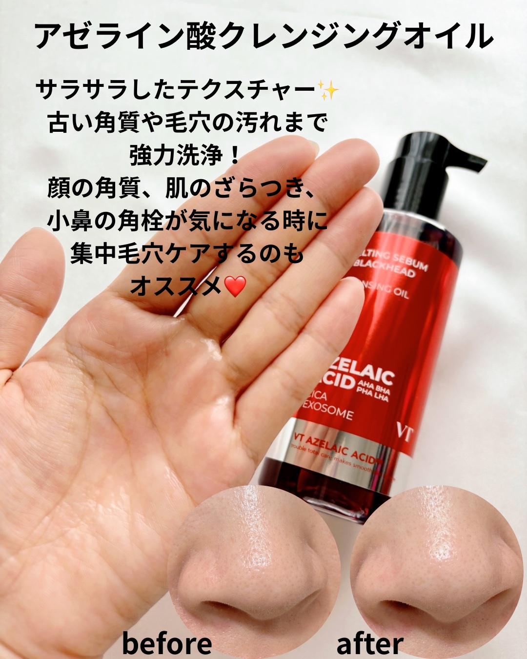 A1カーミング アンプル/VT/美容液を使ったクチコミ（2枚目）