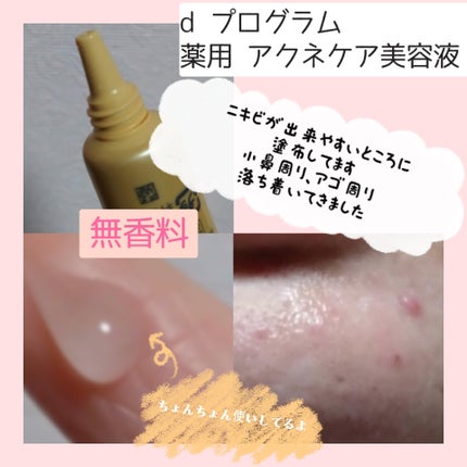 è¬çš ã¢ã¯ãã±ã¢çŸå®¹æ¶²/d ããã°ã©ã /çŸå®¹æ¶²ã䜿ã£ãã¯ãã³ãïŒ4æç®ïŒ