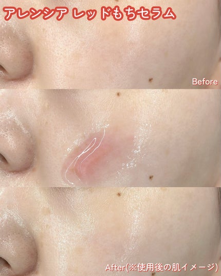 レッドモチセラム30/アレンシア/美容液を使ったクチコミ(4枚目)