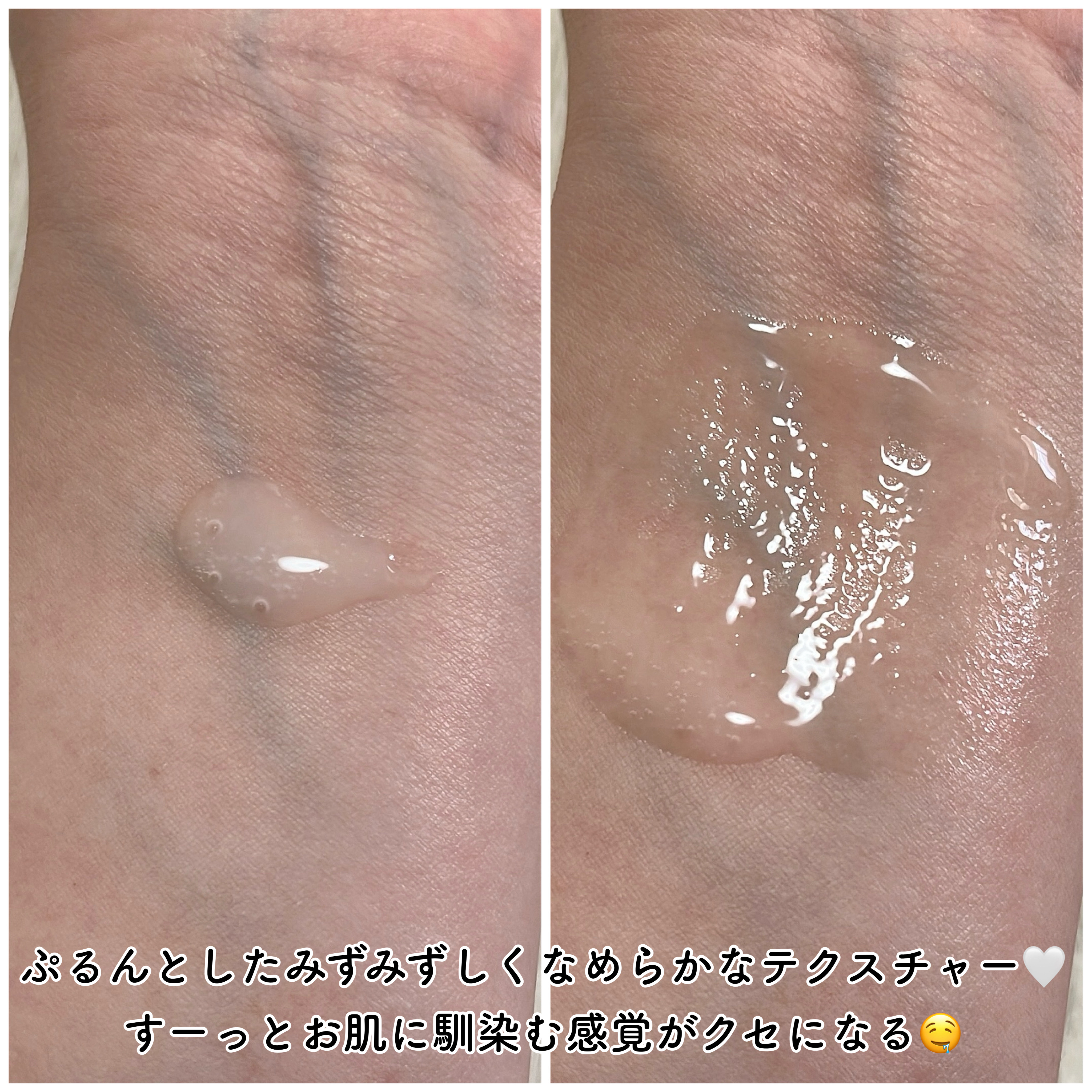 アルティミューン™ パワライジング セラム/SHISEIDO/美容液を使ったクチコミ（3枚目）