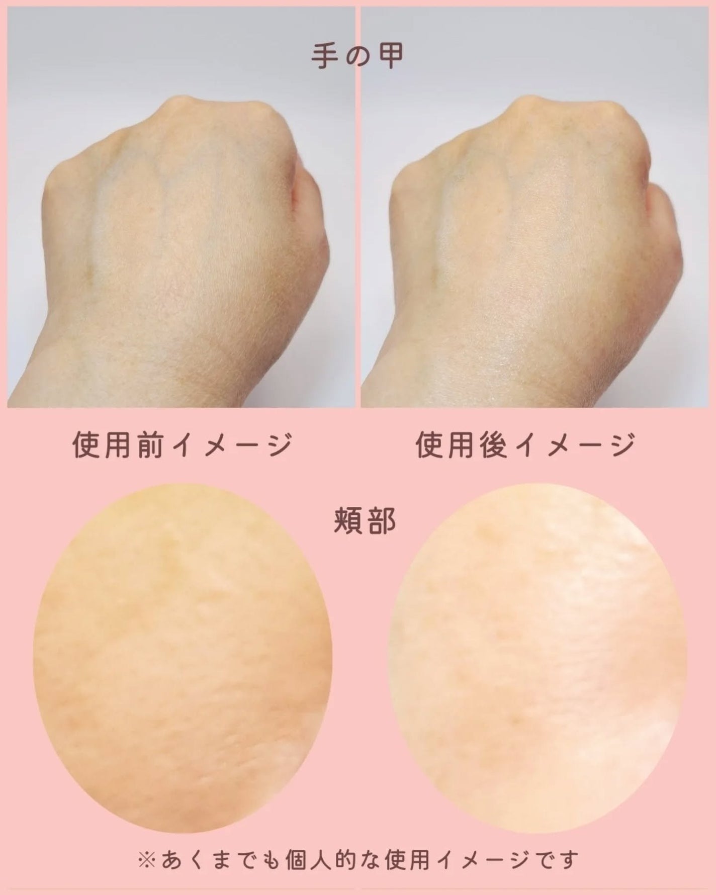 レッドモチセラム30/アレンシア/美容液を使ったクチコミ(5枚目)