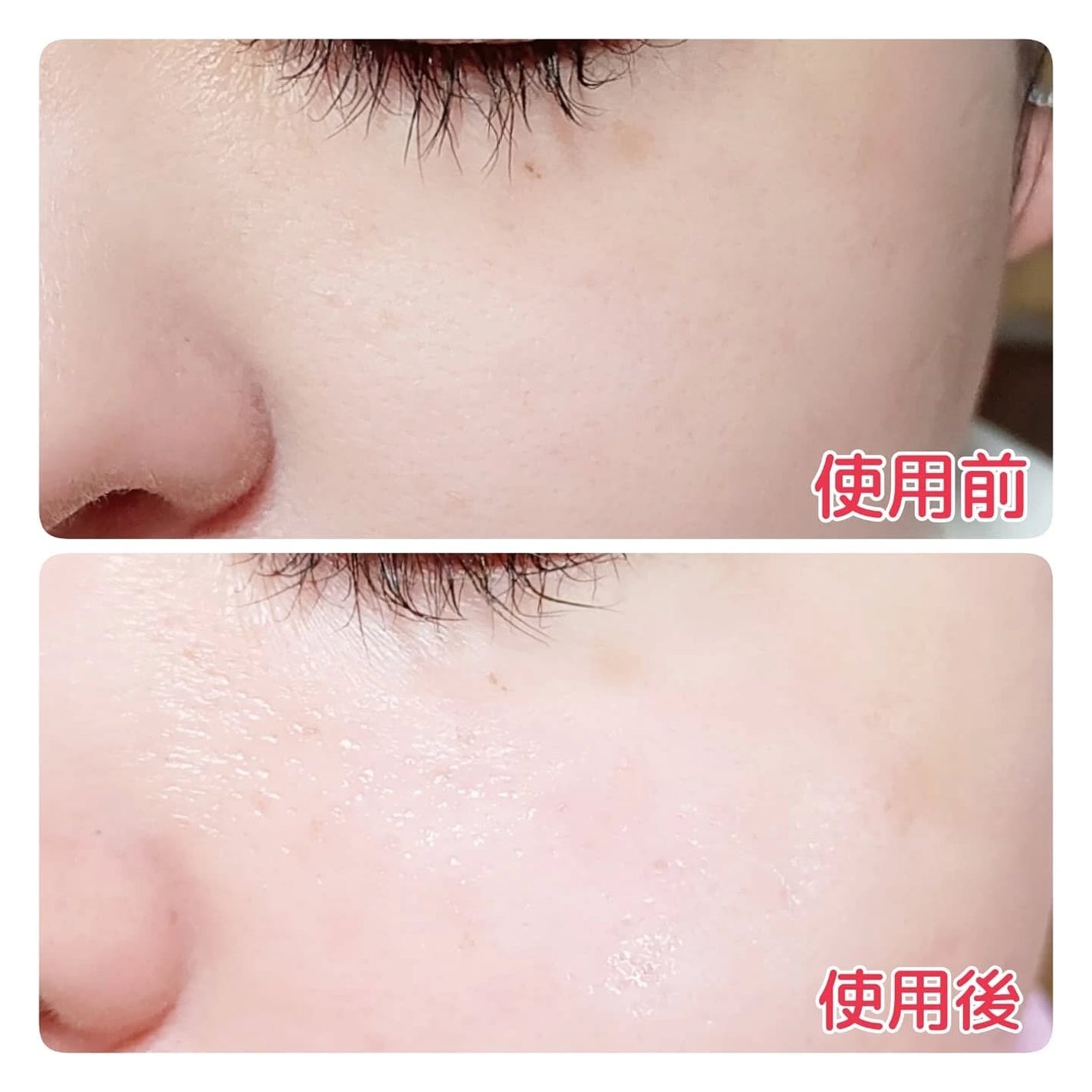 レッドモチセラム30/アレンシア/美容液を使ったクチコミ(4枚目)