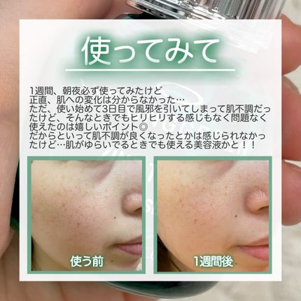 ジンクテカBセラムセット/BRING GREEN/スキンケアキットを使ったクチコミ(5枚目)