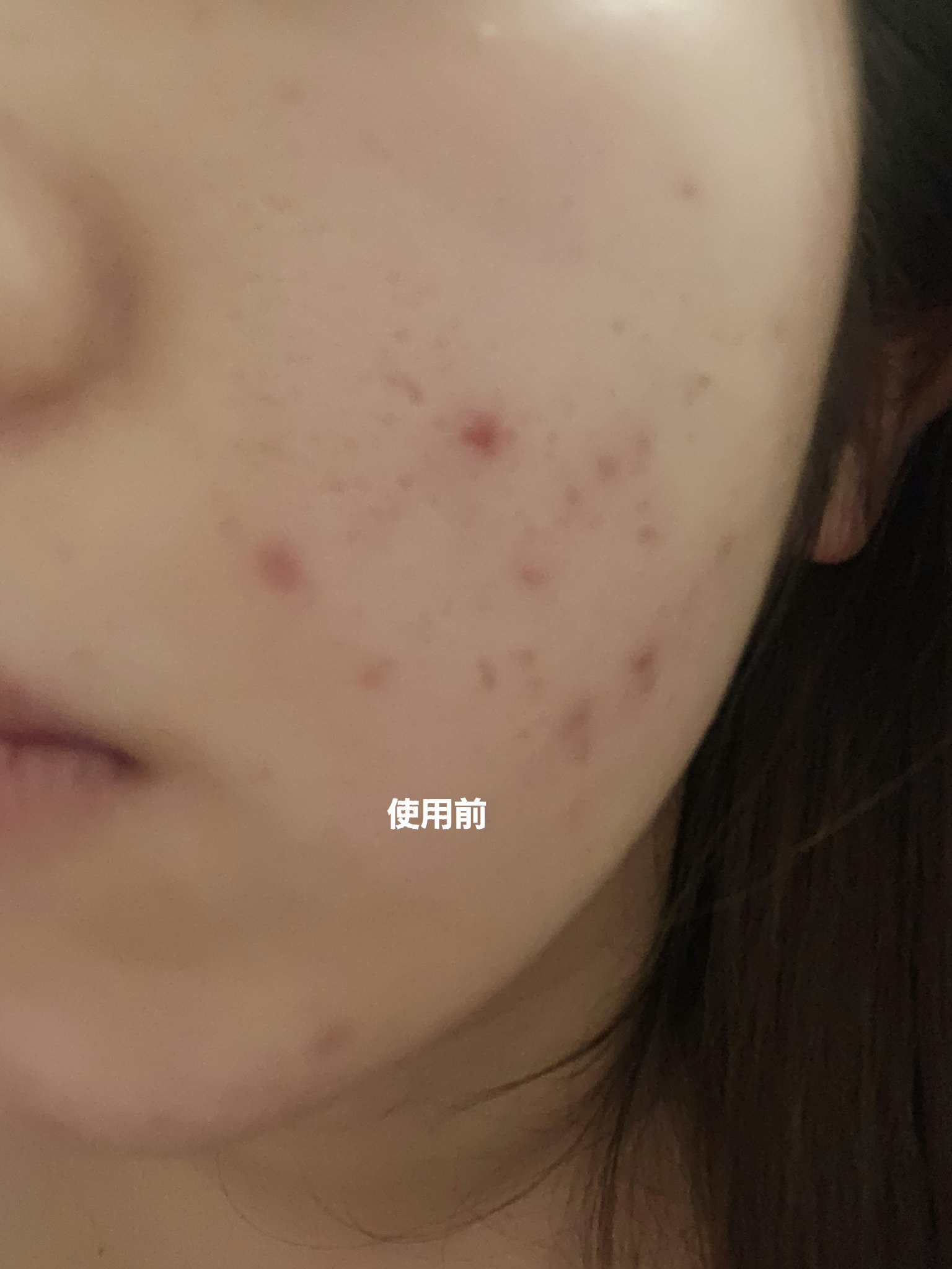 A1カーミング アンプル/VT/美容液を使ったクチコミ（1枚目）