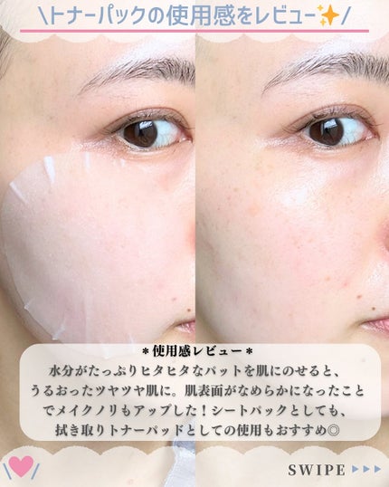 アーニストアイラッシュセラム/BENTON/まつげ美容液を使ったクチコミ(5枚目)