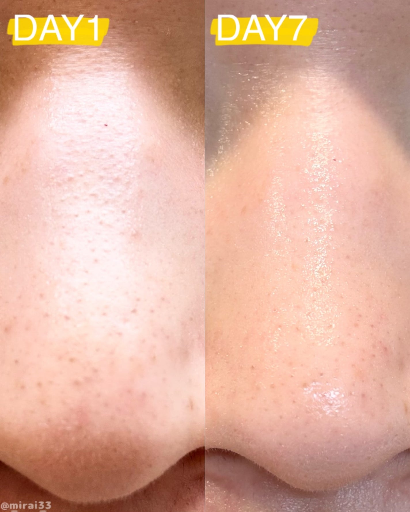 AZケア クレンジングオイル/VT/オイルクレンジングを使ったクチコミ(3枚目)