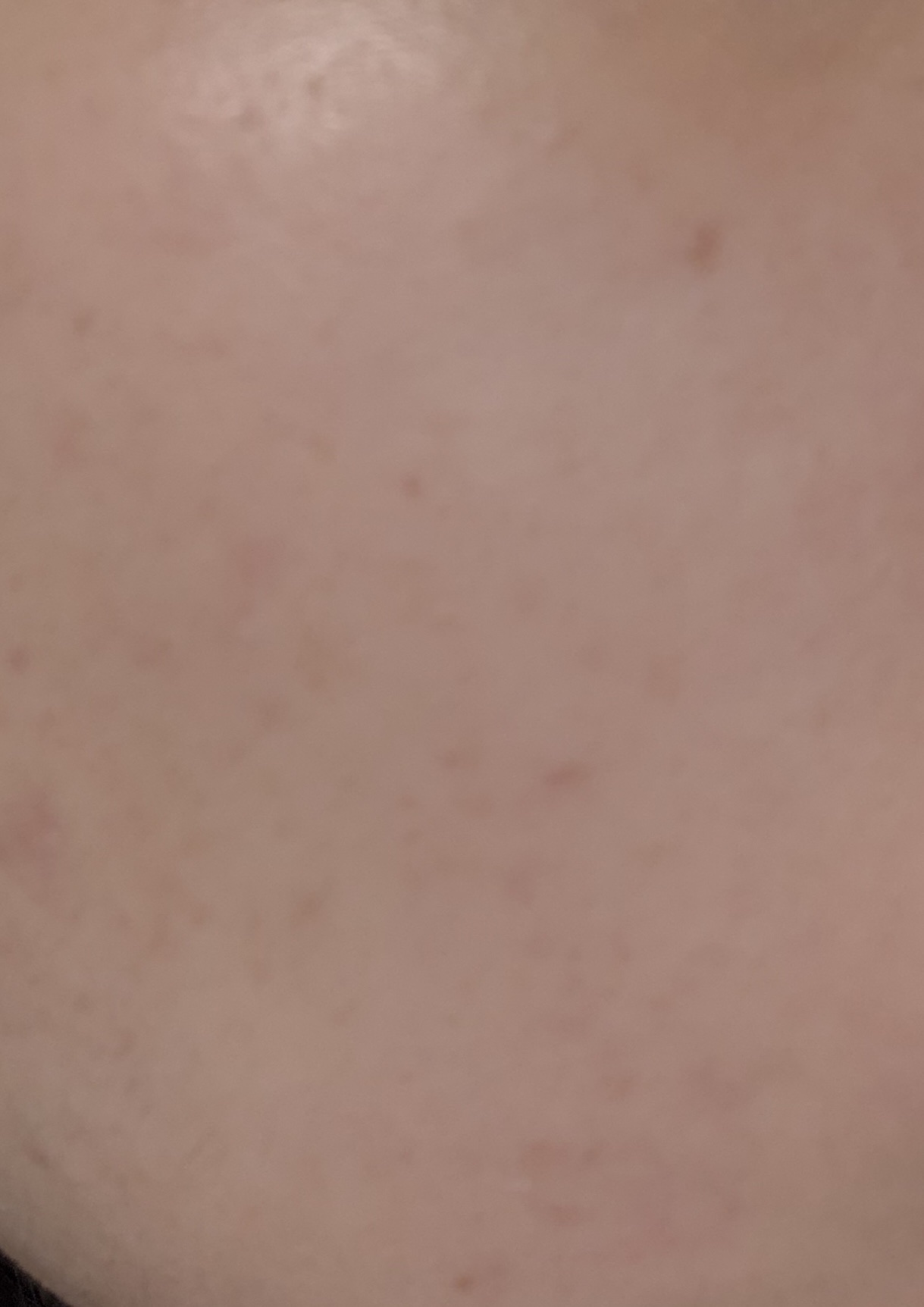 クリアフル ローションM(しっとりタイプ)/オルビス/化粧水を使ったクチコミ（2枚目）