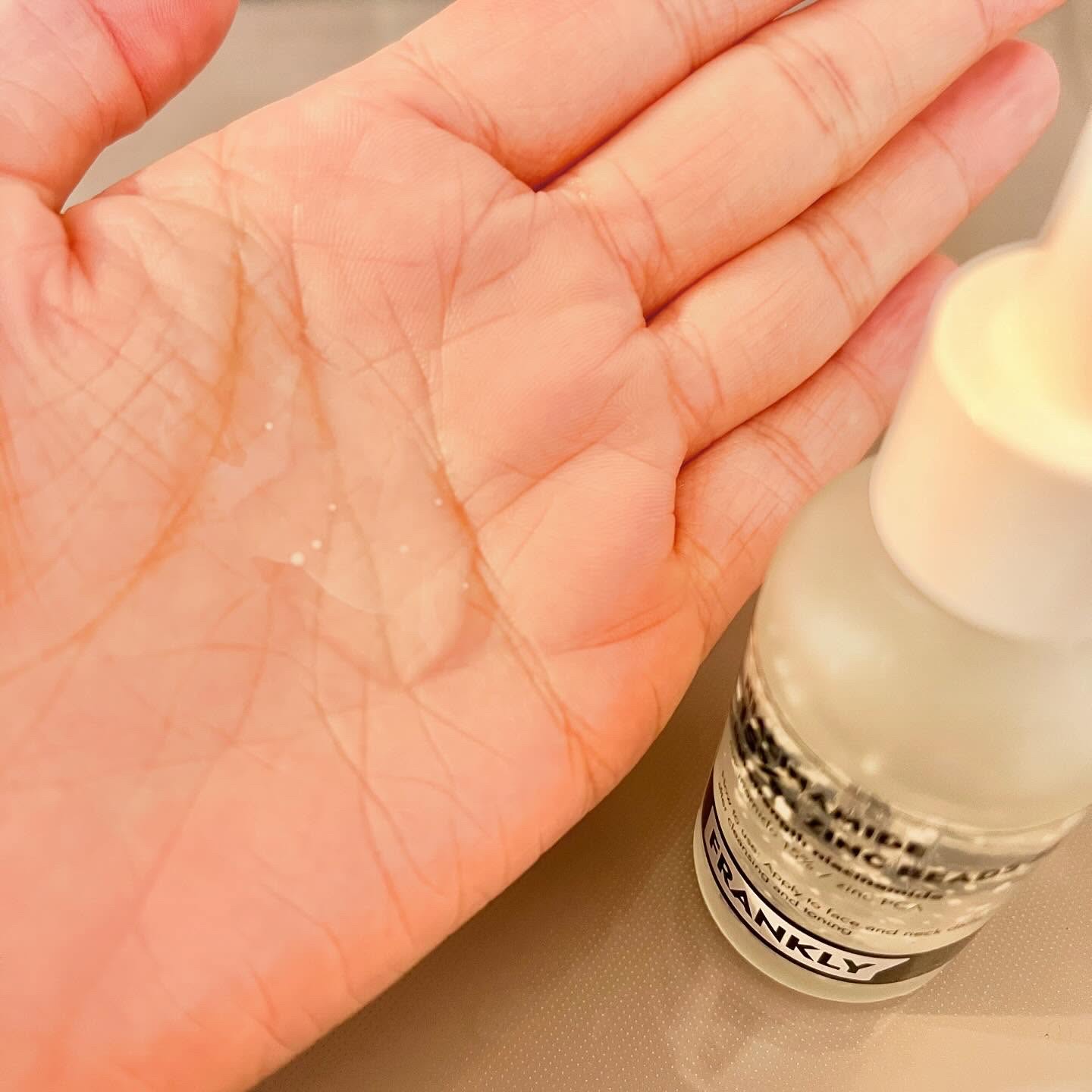 ナイアシンジンクビーズセラム/Frankly/美容液を使ったクチコミ（3枚目）