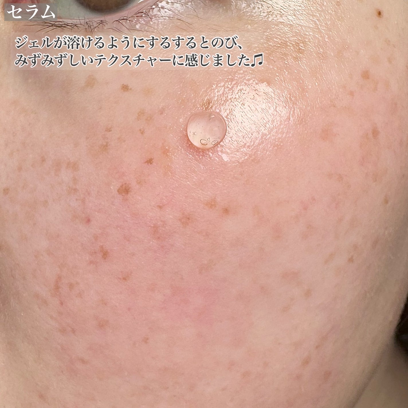 ビタ 5X PDRNセラム/D'amu/美容液を使ったクチコミ(4枚目)