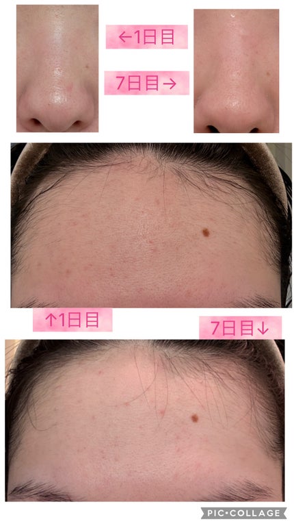 C25リッチセラム/KINUI/美容液を使ったクチコミ(2枚目)