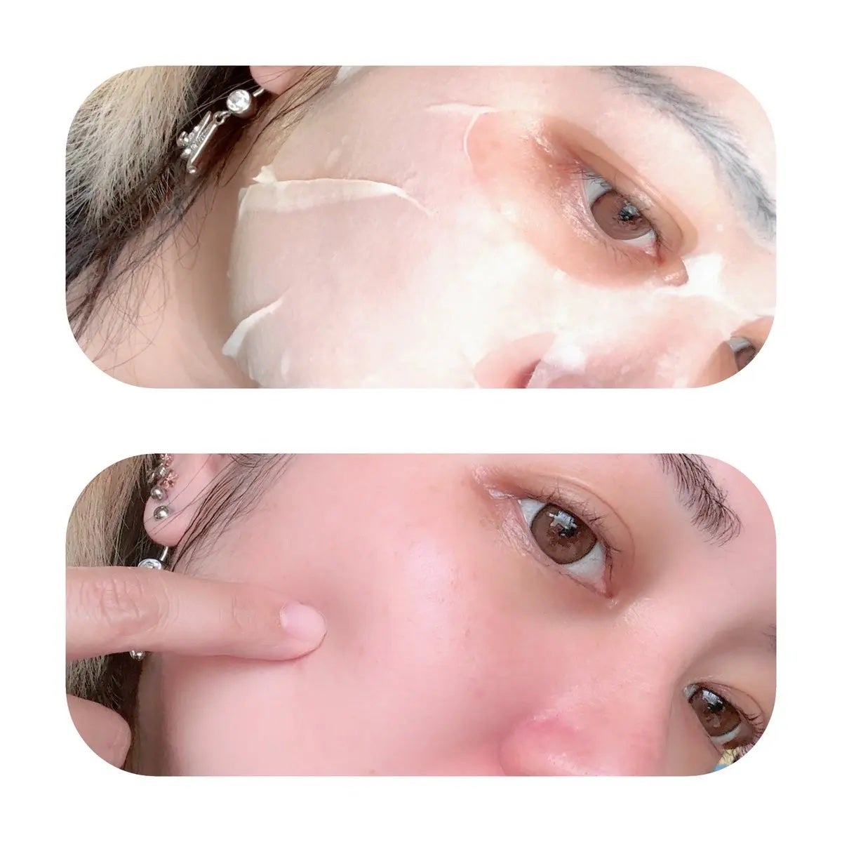 レッドブレミッシュ クイックトーニングTXAマスク/Dr.G/シートマスク・パックを使ったクチコミ(3枚目)