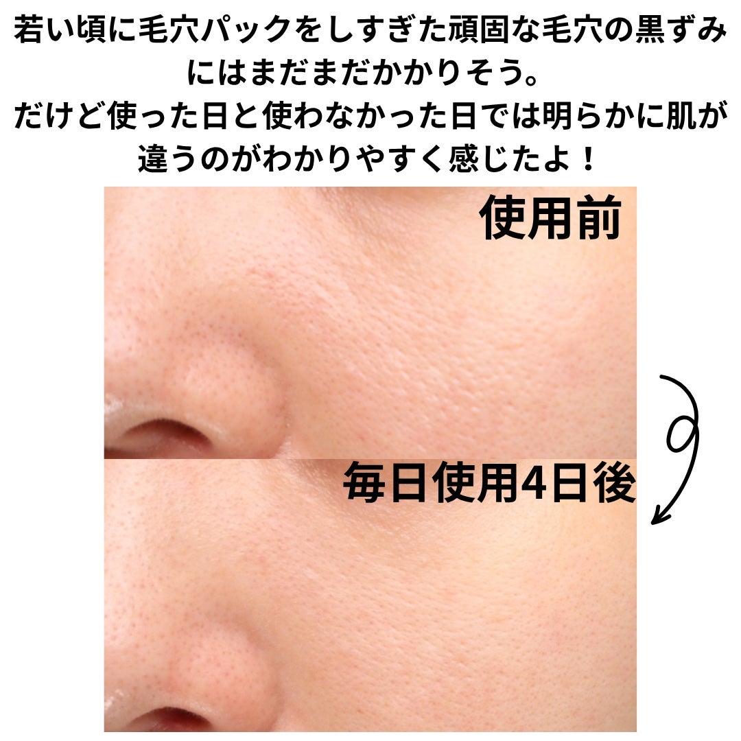 AQ 毛穴美容液オイル/DECORTÉ/フェイスオイルを使ったクチコミ(4枚目)