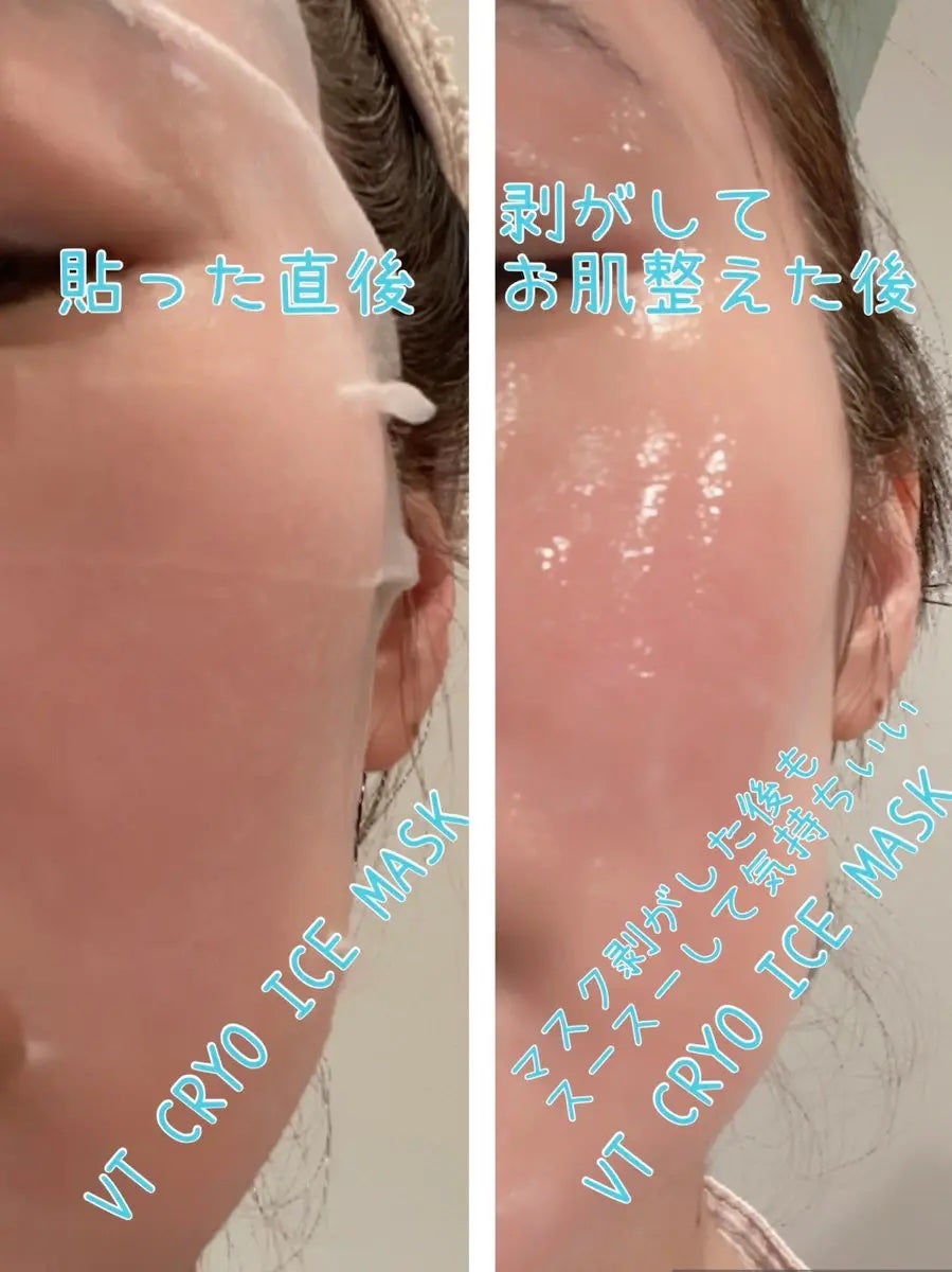 クライオアイス マスク/VT/シートマスク・パックを使ったクチコミ(3枚目)