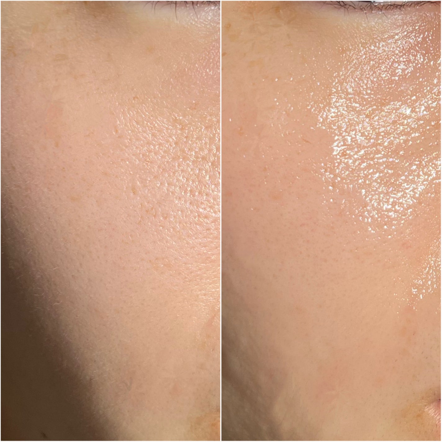 NI【韓国コスメオタク】 on LIPS 「⌇ZEROID︎▶︎ダーマニューアルクレンジングジェル︎\ポイ..」(7枚目)