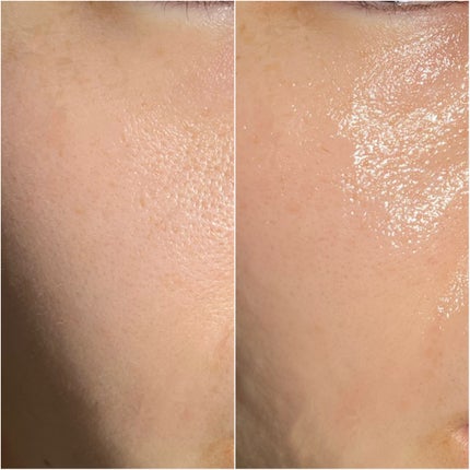 NI【韓国コスメオタク】 on LIPS 「⌇ZEROID︎▶︎ダーマニューアルクレンジングジェル︎\ポイ..」(7枚目)