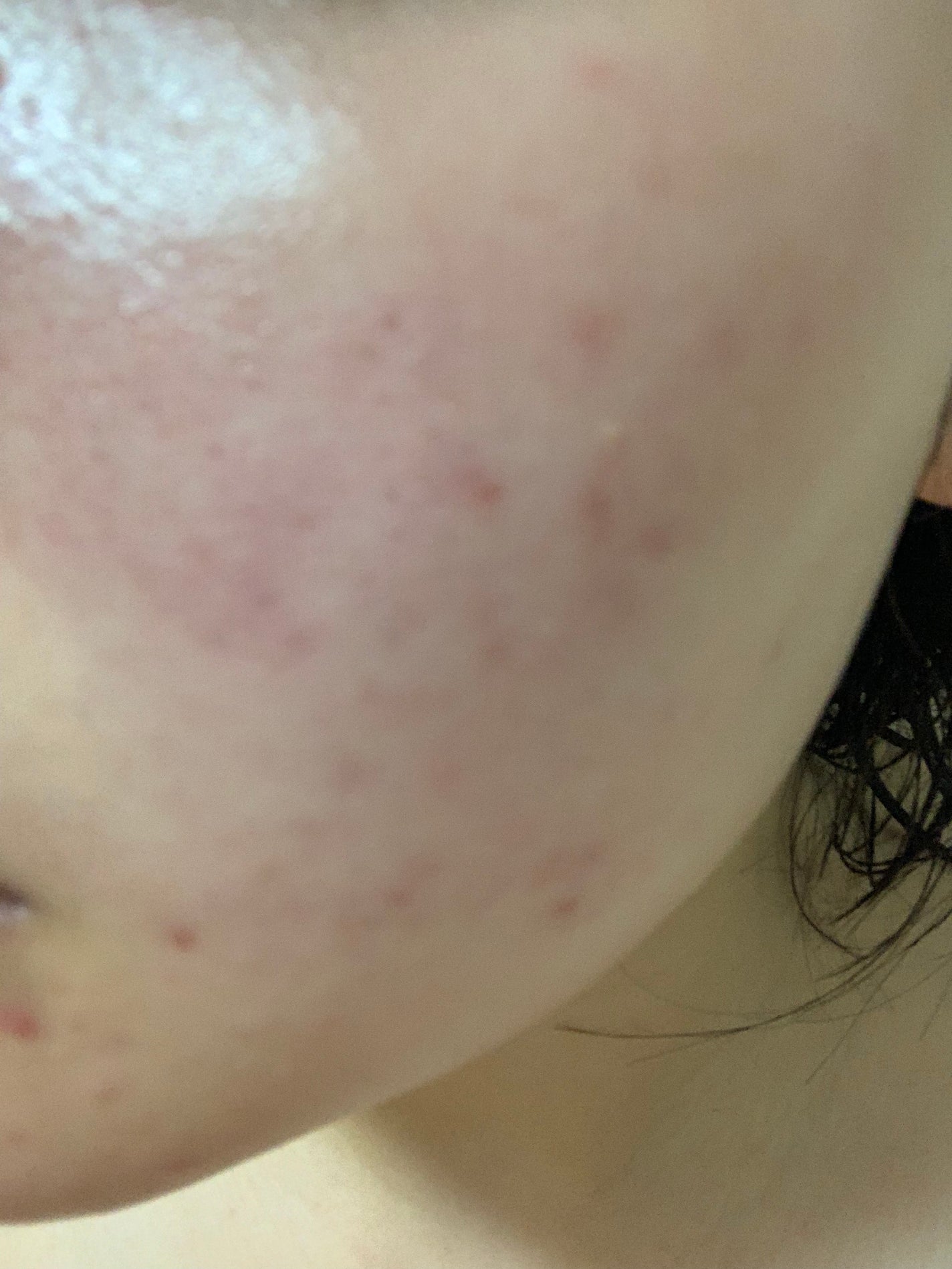 MILK BUBBLE ESSENCE PACK #PLAIN/G9SKIN/美容液を使ったクチコミ(2枚目)