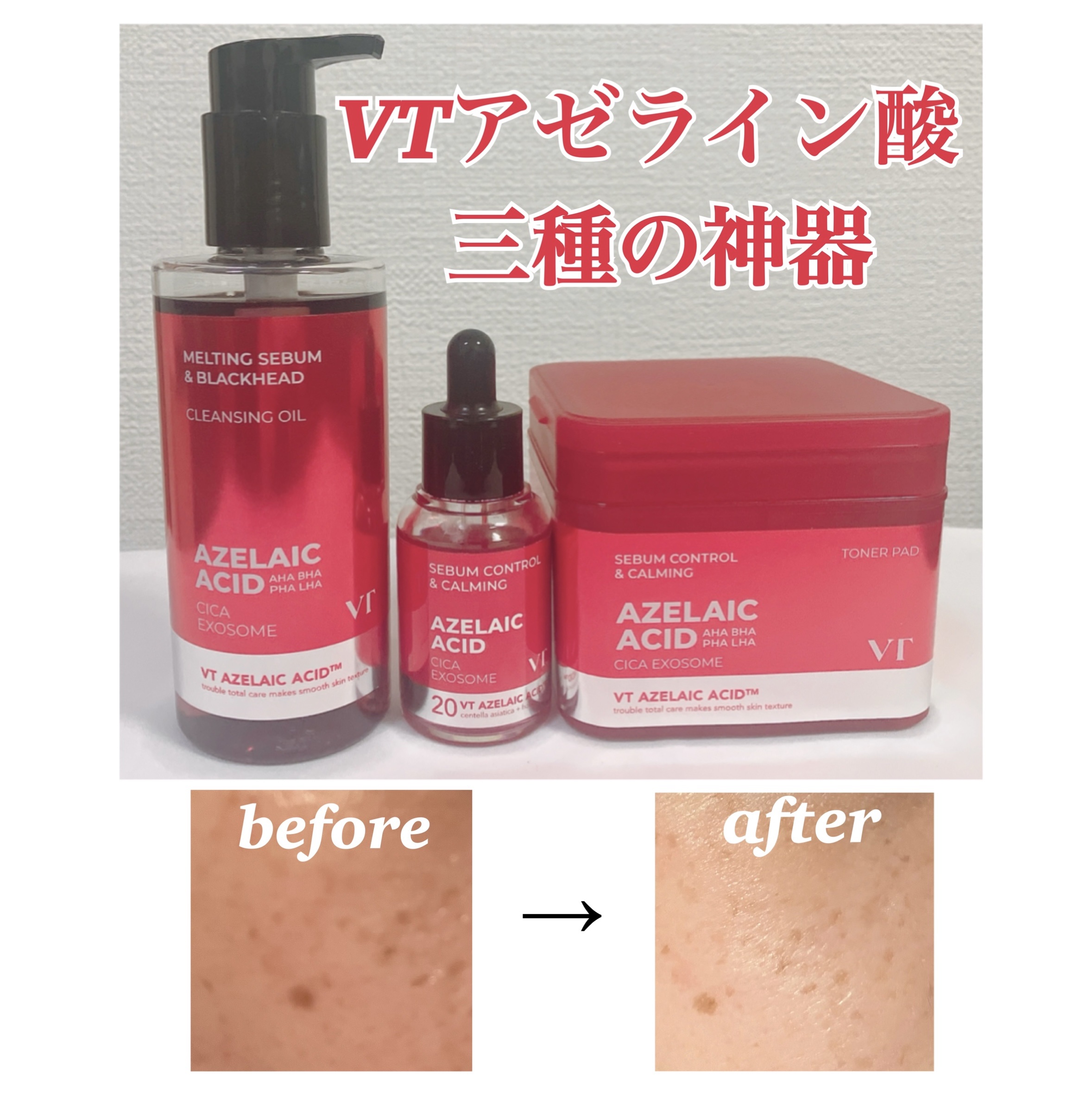 A1カーミング アンプル/VT/美容液を使ったクチコミ（1枚目）