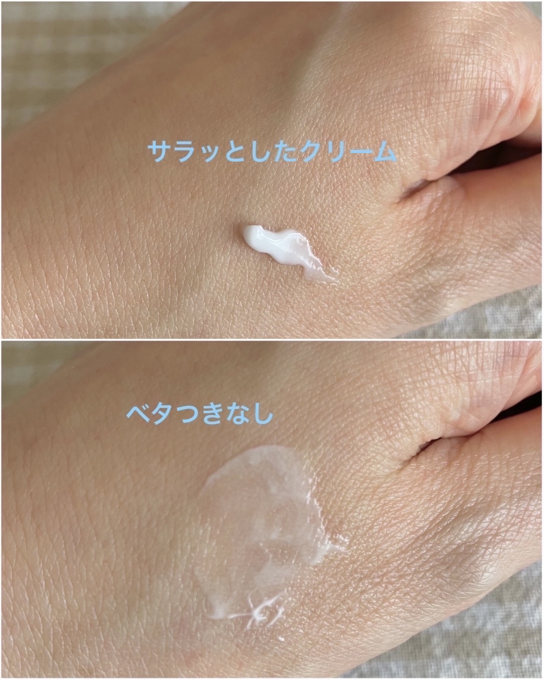 アクネキュアクリーム(医薬品) 16g/IHADA/その他を使ったクチコミ（2枚目）