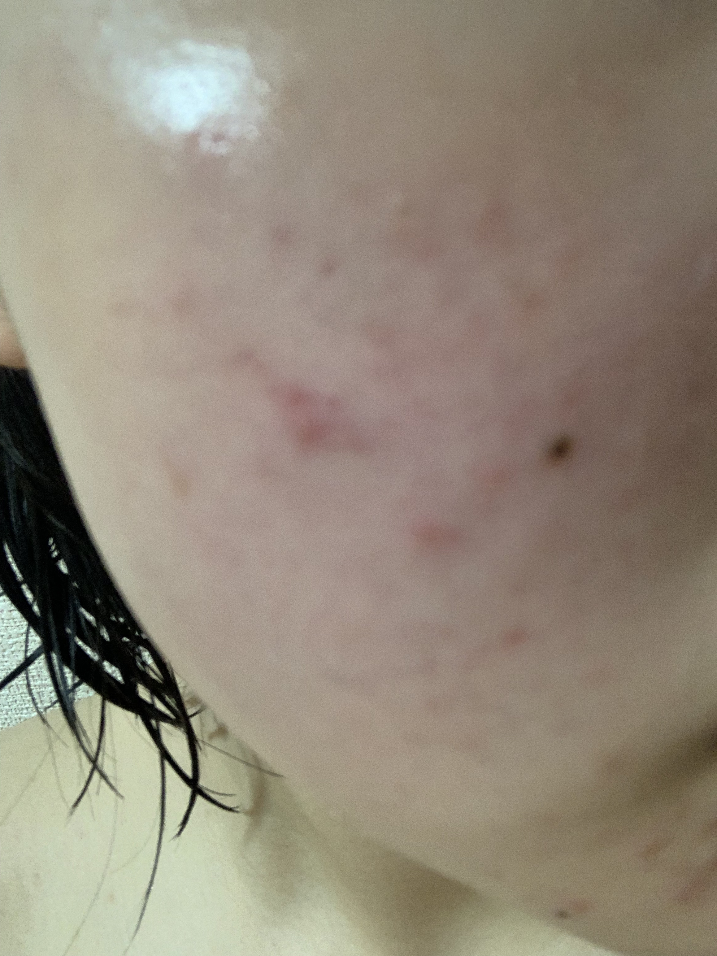 MILK BUBBLE ESSENCE PACK ＃PLAIN/G9SKIN/美容液を使ったクチコミ（3枚目）