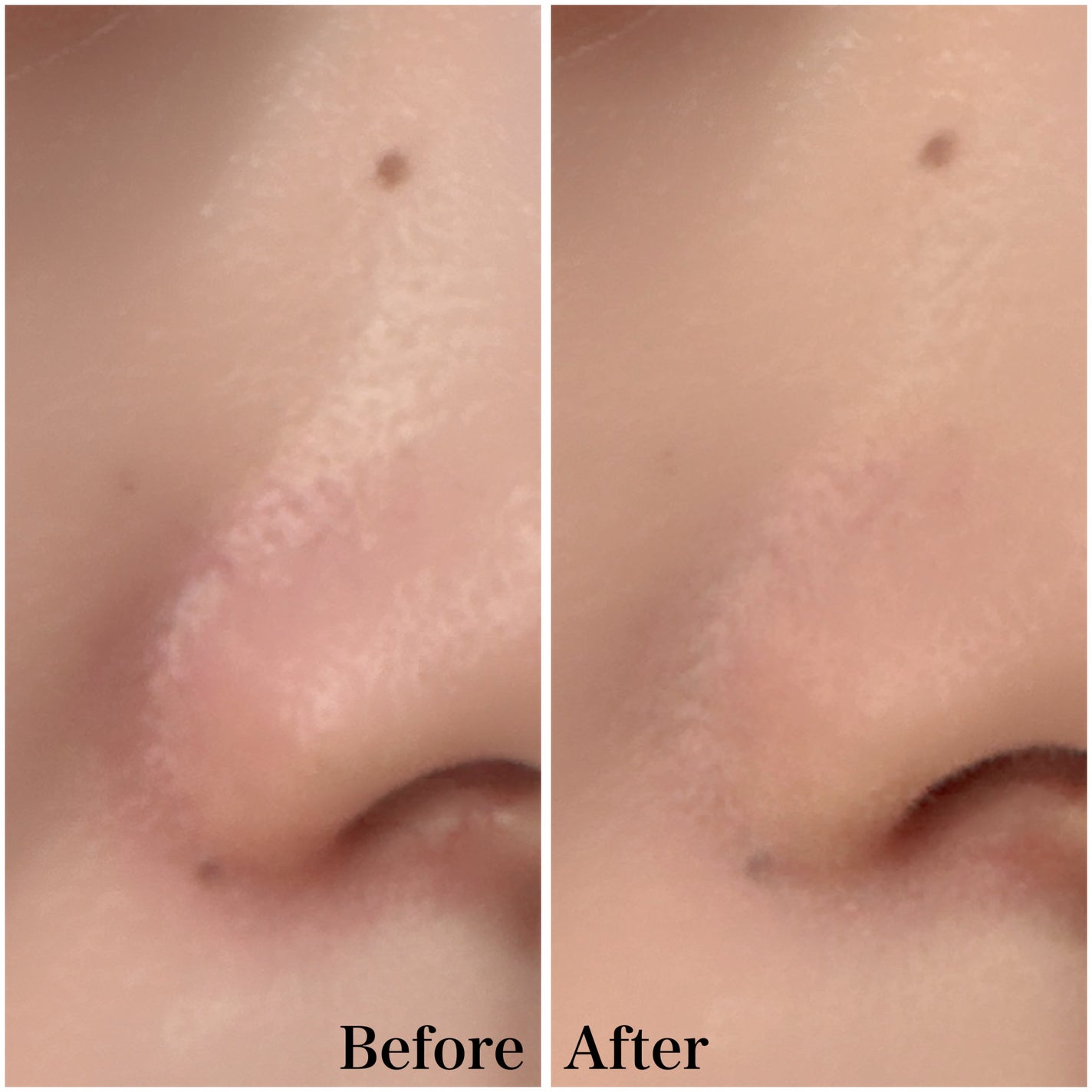 スポットメンテパウダー/muice/プレストパウダーを使ったクチコミ(3枚目)