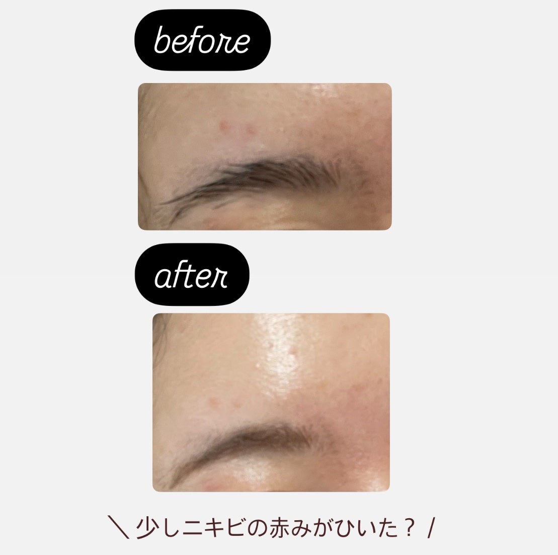 A1カーミング アンプル/VT/美容液を使ったクチコミ(4枚目)