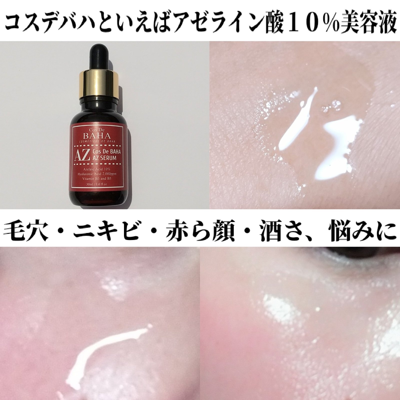 AZアゼライン酸10セラム/コスデバハ/美容液を使ったクチコミ（3枚目）
