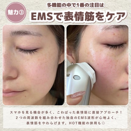 ナリス ルミエ/ナリス化粧品/美顔器・マッサージを使ったクチコミ(6枚目)