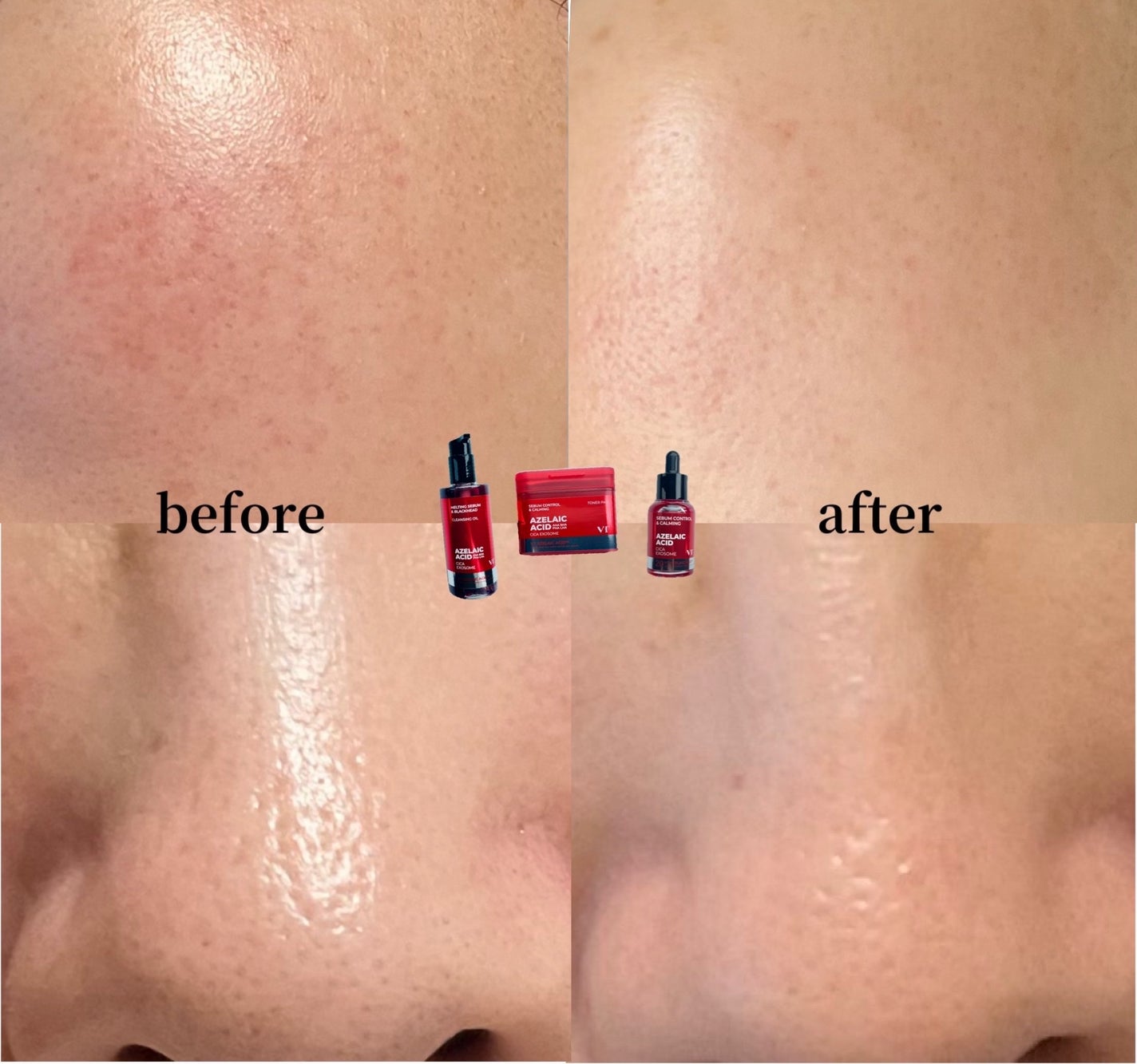 A1カーミング アンプル/VT/美容液を使ったクチコミ(8枚目)