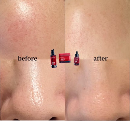 A1カーミング アンプル/VT/美容液を使ったクチコミ(8枚目)