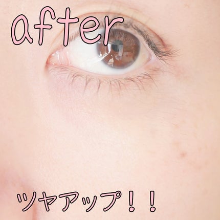 REJURAN デュアルエフェクトアンプル 30ml/REJURAN COSMETICS/美容液を使ったクチコミ(8枚目)