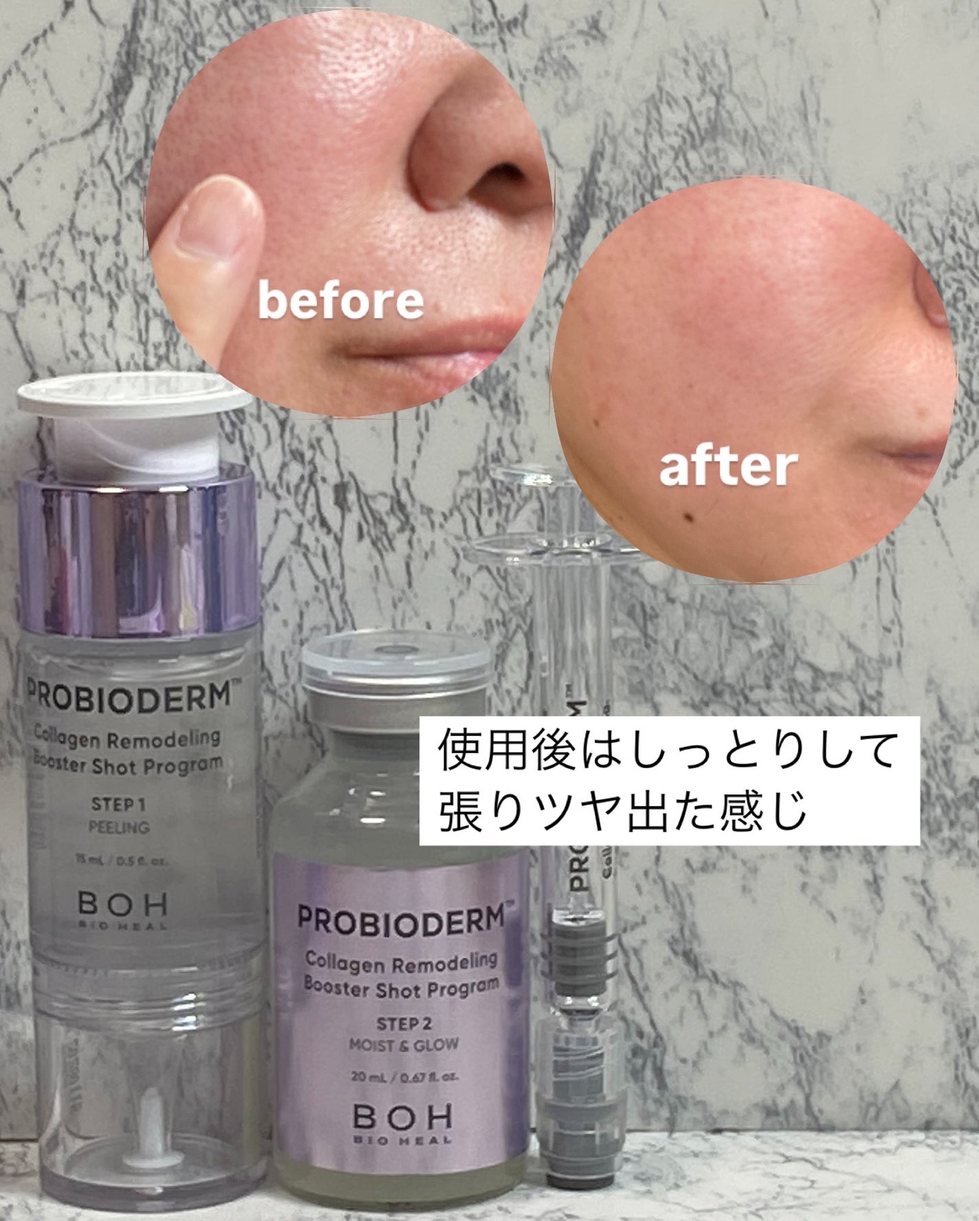 プロバイオダーム™ コラーゲン リモデリング ブースターショット プログラム/BIOHEAL BOH/美容液を使ったクチコミ(7枚目)