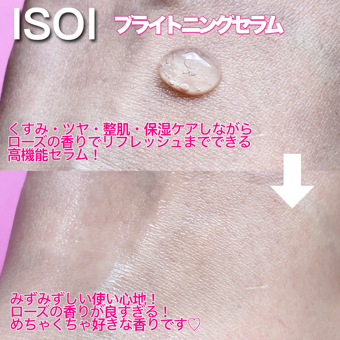 ブレミッシュケアアップ セラム/ISOI/美容液を使ったクチコミ(2枚目)