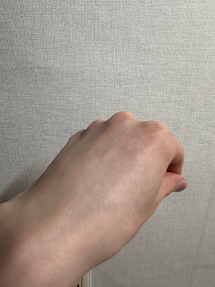 RXザ・アルファアルブチン2 ニキビ跡ケアセラム/COSRX/美容液を使ったクチコミ(3枚目)