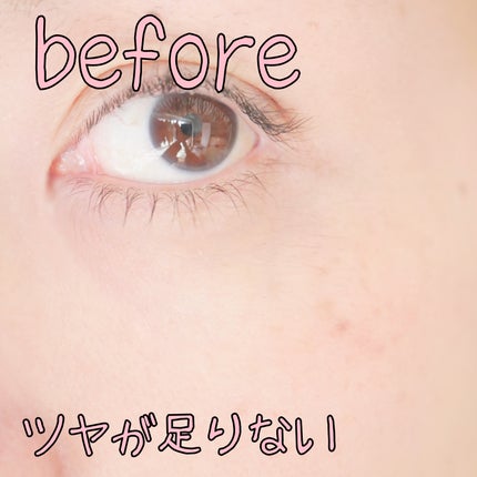 REJURAN デュアルエフェクトアンプル 30ml/REJURAN COSMETICS/美容液を使ったクチコミ(7枚目)