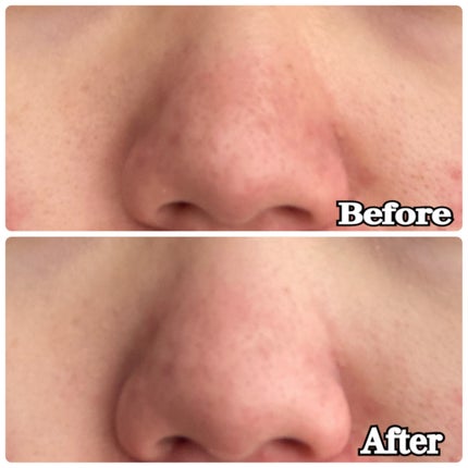 アレンシアフレッシュもちソープ「ロイヤルローズヒップ」/アレンシア/その他洗顔料を使ったクチコミ(8枚目)