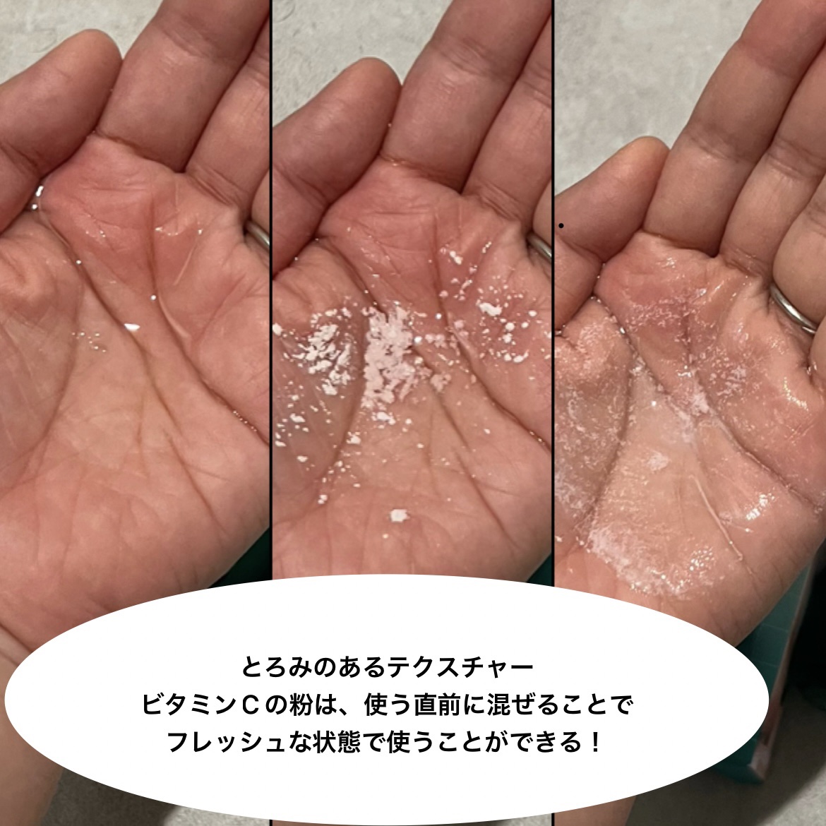 ジンクテカBセラムセット/BRING GREEN/スキンケアキットを使ったクチコミ（2枚目）