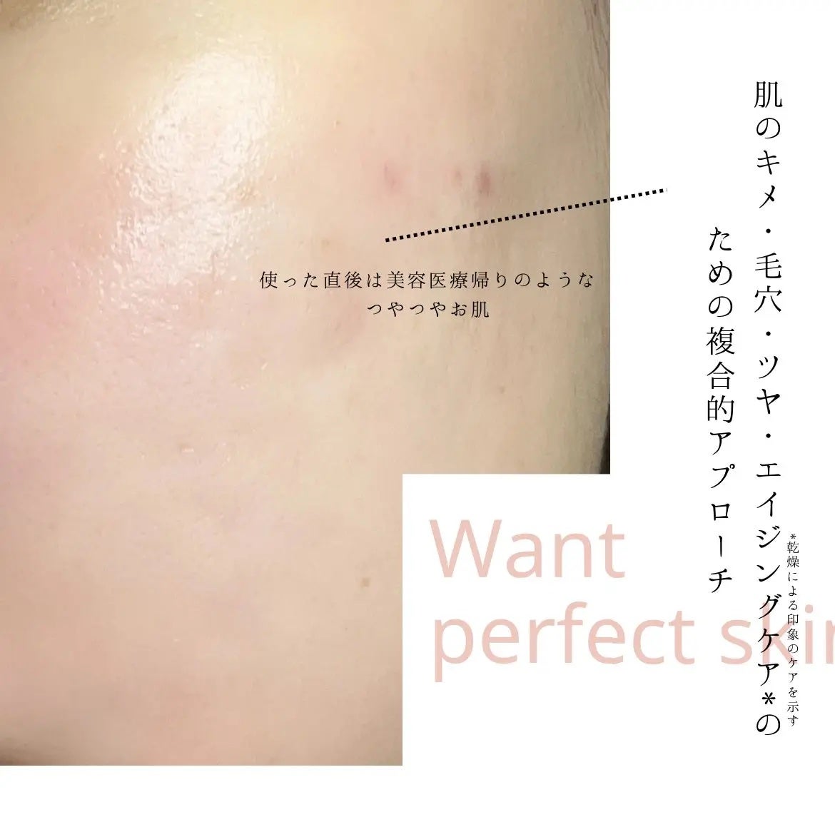 EXO−Vプロリフティング MTSアンプル/id PLACOSMETICS/美容液を使ったクチコミ(4枚目)