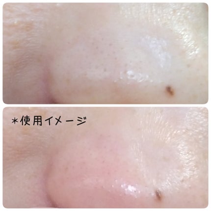 A1カーミング アンプル/VT/美容液を使ったクチコミ(6枚目)