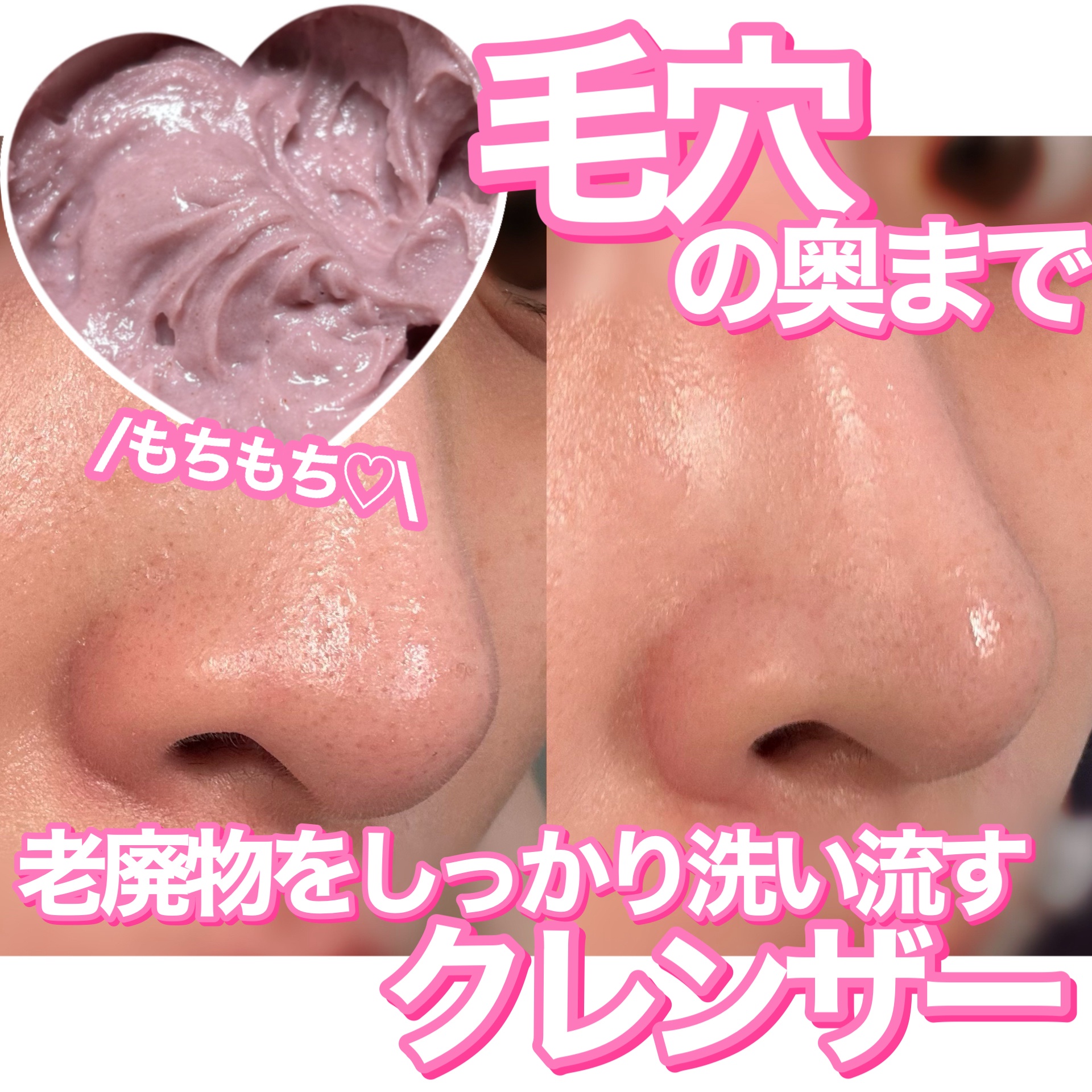 アレンシアフレッシュもちソープ「ロイヤルローズヒップ」/アレンシア/その他洗顔料を使ったクチコミ（1枚目）