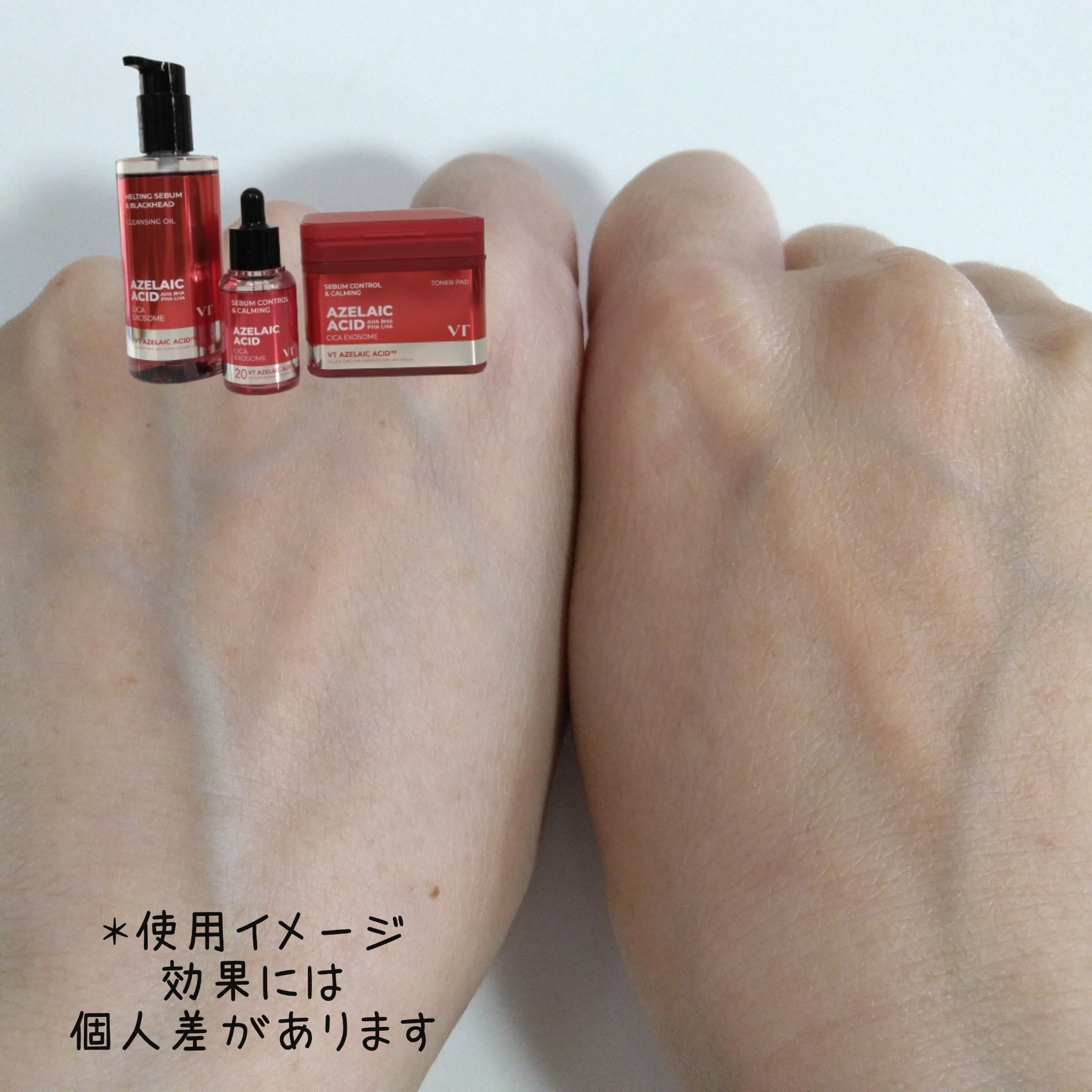 A1カーミング アンプル/VT/美容液を使ったクチコミ（1枚目）