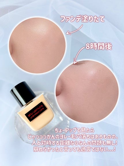 ã¢ã³ãªãããã ã±ã¢ ã〠ã»ã©ã ãã¡ã³ããŒã·ã§ã³/shu uemura/ãªããããã¡ã³ããŒã·ã§ã³ã䜿ã£ãã¯ãã³ãïŒ5æç®ïŒ