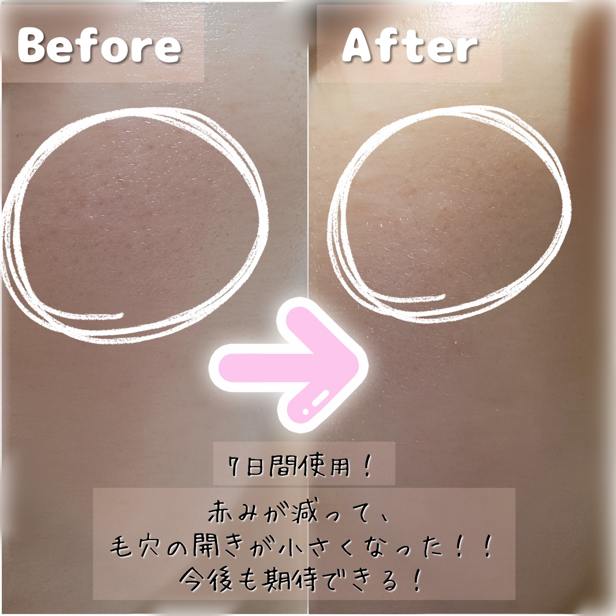 AZケア トナーパッド/VT/トナーパッドを使ったクチコミ（2枚目）